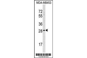Image no. 1 for anti-Axin Interactor, Dorsalization Associated (AIDA) (AA 255-283), (C-Term) antibody (ABIN1536951)