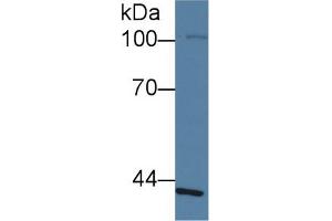 Image no. 3 for anti-Schlafen Family Member 5 (SLFN5) (AA 658-891) antibody (ABIN5014293)