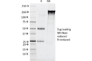 Image no. 5 for anti-Elastase 3B, Pancreatic (ELA3B) (AA 82-238) antibody (ABIN6939418)