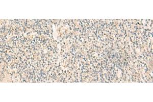 Immunohistochemistry of paraffin-embedded Human tonsil tissue using NGEF Polyclonal Antibody at dilution of 1:35(x200)