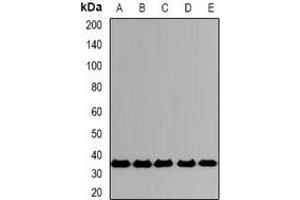 Image no. 1 for anti-SLAM Family Member 7 (SLAMF7) antibody (ABIN3197582)