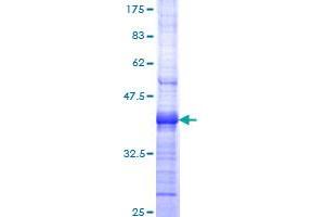 Image no. 1 for BCL2-Like 11 (Apoptosis Facilitator) (BCL2L11) (AA 1-100) protein (GST tag) (ABIN1346562)