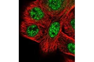 Image no. 1 for anti-SET Domain Containing 1A (SETD1A) antibody (ABIN5587776)