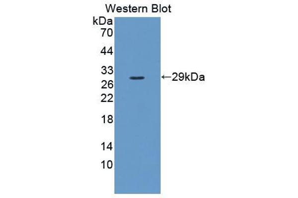 anti-Fibrosin (FBS) (AA 11-247) antibody