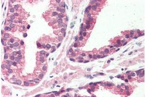 G Protein-Coupled Receptor 126 antibody  (N-Term)