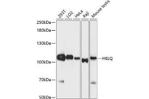 Western blot analysis of extracts of various cell lines using HEL308 Polyclonal Antibody at dilution of 1:3000.