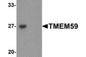 Image no. 1 for anti-Transmembrane Protein 59 (TMEM59) (N-Term) antibody (ABIN783793)