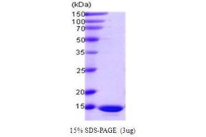 Programmed Cell Death 5 (PDCD5) (AA 1-125) protein
