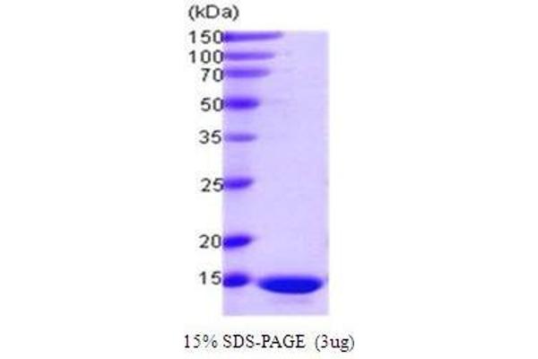 Programmed Cell Death 5 (PDCD5) (AA 1-125) protein