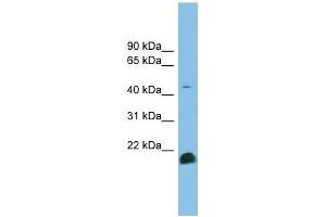Image no. 1 for anti-Transforming Growth Factor, beta 2 (TGFB2) (Middle Region) antibody (ABIN634909)