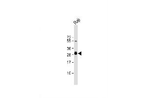 Image no. 3 for anti-Major Histocompatibility Complex, Class II, DP beta 1 (HLA-DPB1) (AA 77-105) antibody (ABIN657755)