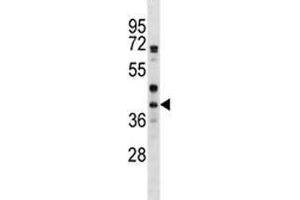 Image no. 1 for anti-Wingless-Type MMTV Integration Site Family, Member 6 (WNT6) (AA 173-201) antibody (ABIN3029637)