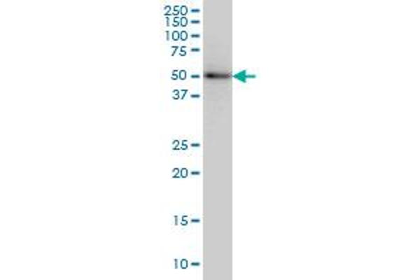 anti-Solute Carrier Family 29 (Nucleoside Transporters), Member 4 (SLC29A4) (AA 283-345) antibody