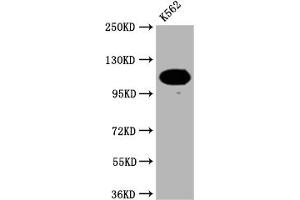 Western Blot Positive WB detected in: K562 whole cell lysate All lanes: PARP antibody at 1:2000 Secondary Goat polyclonal to rabbit IgG at 1/50000 dilution Predicted band size: 114 KDa Observed band size: 114 kDa