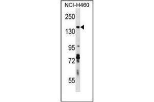 Image no. 1 for anti-Diaphanous Homolog 3 (Drosophila) (DIAPH3) (AA 1060-1090), (C-Term) antibody (ABIN951910)
