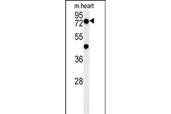 PHTF2 抗体  (AA 420-448)