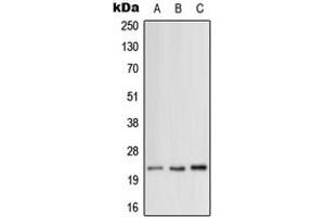 Image no. 1 for anti-Mitochondrial Ribosomal Protein L12 (MRPL12) (Center) antibody (ABIN2706594)