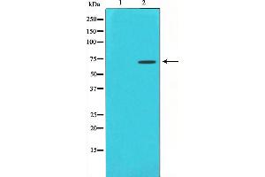Image no. 2 for anti-Histone Deacetylase 10 (HDAC10) antibody (ABIN6262173)