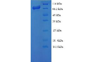 Image no. 1 for Doublecortin-Like Kinase 1 (DCLK1) (AA 1-754), (full length) protein (His-SUMO Tag) (ABIN5711159)