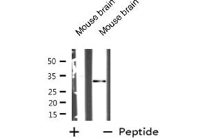 Image no. 2 for anti-Myristoylated Alanine-Rich Protein Kinase C Substrate (MARCKS) antibody (ABIN6263130)