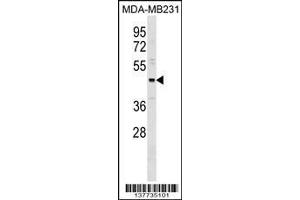 Image no. 1 for anti-One Cut Homeobox 3 (ONECUT3) (AA 393-419), (C-Term) antibody (ABIN1537263)