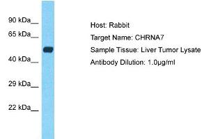 Image no. 1 for anti-Cholinergic Receptor, Nicotinic, alpha 7 (Neuronal) (CHRNA7) (C-Term) antibody (ABIN2774850)