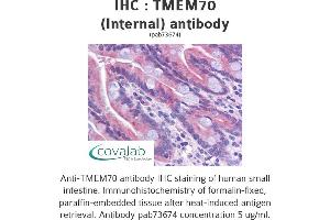 Image no. 1 for anti-Transmembrane Protein 70 (TMM70) (Internal Region) antibody (ABIN1740162)