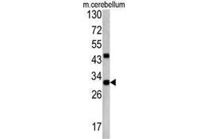 Image no. 4 for anti-ZW10 Interactor (ZWINT) (Middle Region) antibody (ABIN453487)