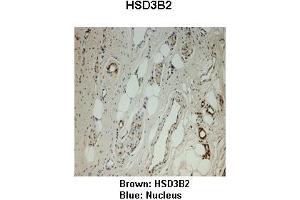 Image no. 2 for anti-Hydroxy-delta-5-Steroid Dehydrogenase, 3 beta- and Steroid delta-Isomerase 2 (HSD3B2) (N-Term) antibody (ABIN2781776)
