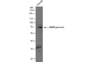 Image no. 2 for anti-Protein Kinase, AMP-Activated, gamma 2 Non-Catalytic Subunit (PRKAG2) (full length) antibody (ABIN2856652)