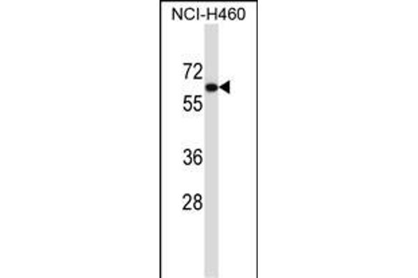 UGT2B11 抗体  (C-Term)