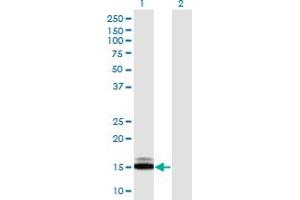 Western Blot analysis of SUMO1 expression in transfected 293T cell line by SUMO1 monoclonal antibody (M03), clone 3D7.