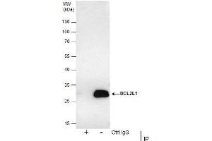 Image no. 5 for anti-BCL2-Like 1 (BCL2L1) (Center) antibody (ABIN2856151)