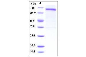 Image no. 1 for Reticulon 4 Receptor (RTN4R) (AA 1-447), (Mature) (Active) protein (Fc Tag,His tag) (ABIN2002901)