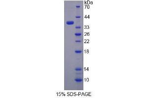 Image no. 1 for Thiosulfate Sulfurtransferase (Rhodanese) (TST) (AA 2-297) protein (His tag) (ABIN6239479)