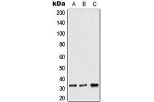 Image no. 2 for anti-Transformer 2 alpha Homolog (TRA2A) (C-Term) antibody (ABIN2705303)