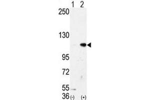 Image no. 3 for anti-Lysine (K)-Specific Demethylase 1A (KDM1A) (AA 108-142) antibody (ABIN3031651)