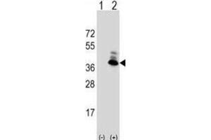 Image no. 1 for anti-Aspartoacylase (ASPA) antibody (ABIN3002840)