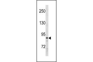 Image no. 1 for anti-SUZ12 Polycomb Repressive Complex 2 Subunit (SUZ12) (AA 559-588), (C-Term) antibody (ABIN1881858)