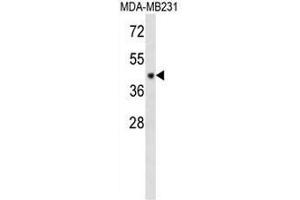 Image no. 2 for anti-Chromosome 6 Open Reading Frame 150 (C6orf150) (AA 273-303), (Middle Region) antibody (ABIN950947)