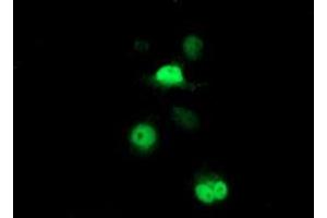 Image no. 1 for anti-Proteasome (Prosome, Macropain) Subunit, beta Type, 7 (PSMB7) (AA 58-277) antibody (ABIN2729938)