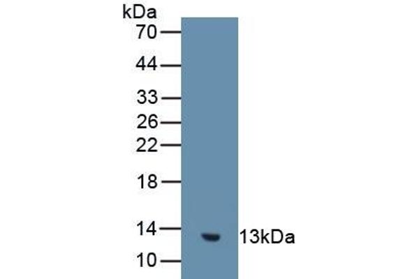 GUCA2B anticorps  (AA 27-112)