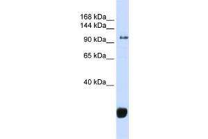 Image no. 1 for anti-F-Box Protein 10 (FBXO10) (Middle Region) antibody (ABIN2785925)