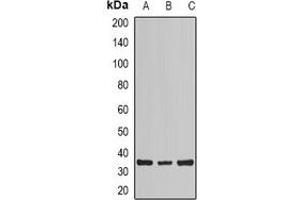Image no. 1 for anti-Myozenin 2 (MYOZ2) antibody (ABIN3197572)