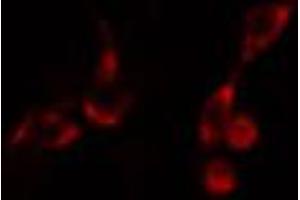 Image no. 2 for anti-PDZ Domain Containing 2 (PDZD2) antibody (ABIN6264123)