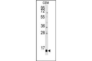 Image no. 1 for anti-Prefoldin Subunit 6 (PFDN6) (C-Term), (N-Term) antibody (ABIN358008)