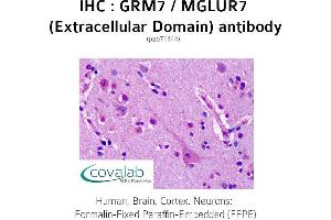 Image no. 1 for anti-Glutamate Receptor, Metabotropic 7 (GRM7) (2nd Extracellular Domain) antibody (ABIN1735279)