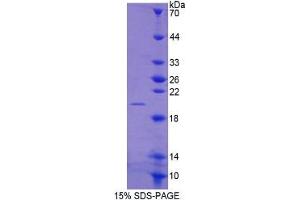 Image no. 4 for Matrix Metallopeptidase 13 (Collagenase 3) (MMP13) ELISA Kit (ABIN6730928)