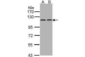 Image no. 1 for anti-Glutamyl Aminopeptidase (Aminopeptidase A) (ENPEP) (C-Term) antibody (ABIN2855494)