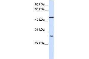 Image no. 1 for anti-Transmembrane Protein 127 (TMEM127) (Middle Region) antibody (ABIN2782923)